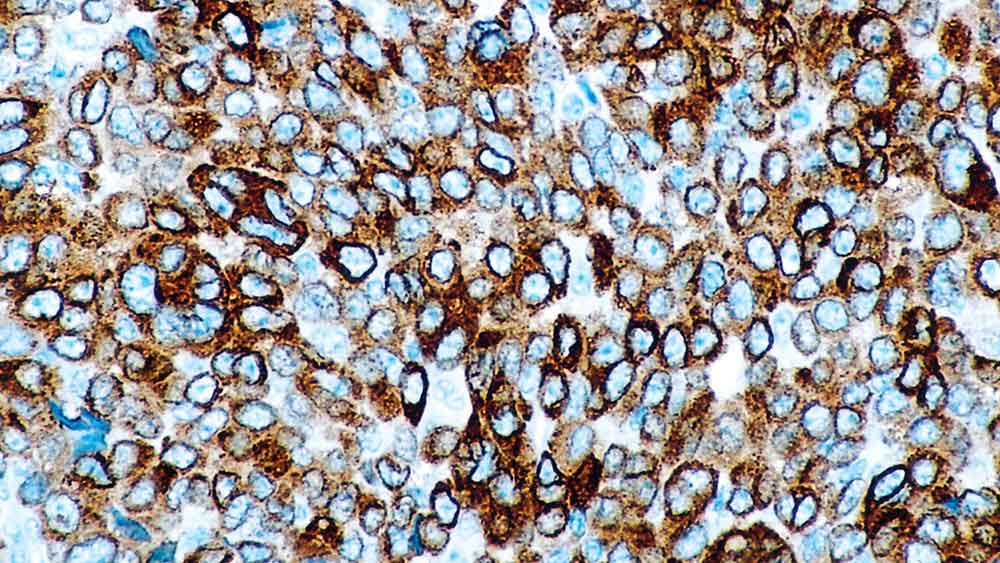 Bilde av Leica Antistoffer