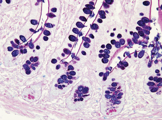 Eksempel på AB-PAS spesialfarge